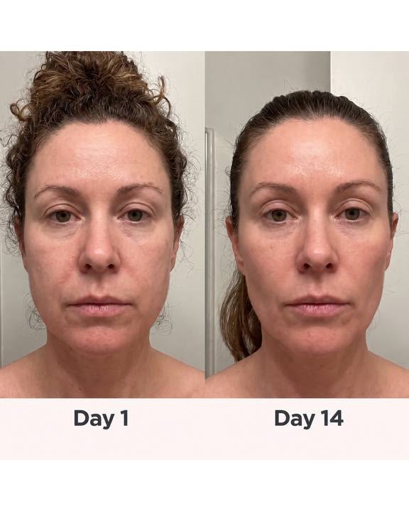 Puffy face before and after