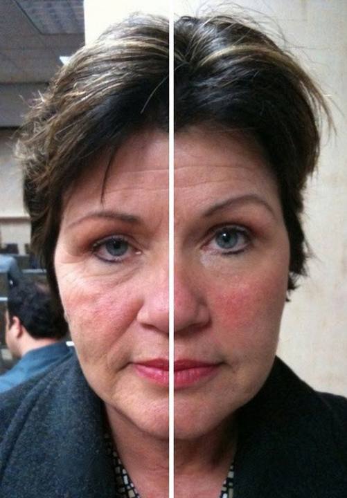 Before and after