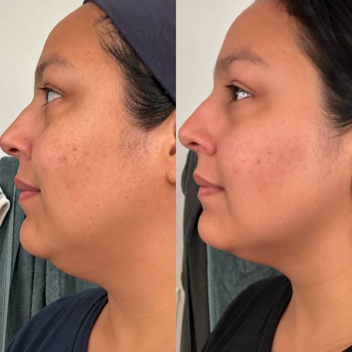 Before and after