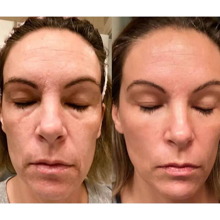 Before and after