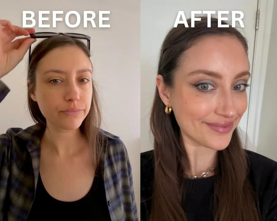 Nuvetra Chin & Face Lift Roller