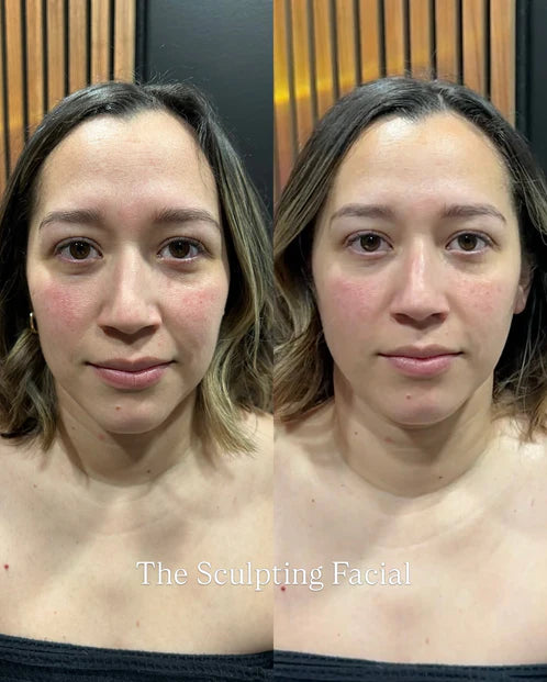 Before and after 1 — Nuvetra Lymphatic Face Brush