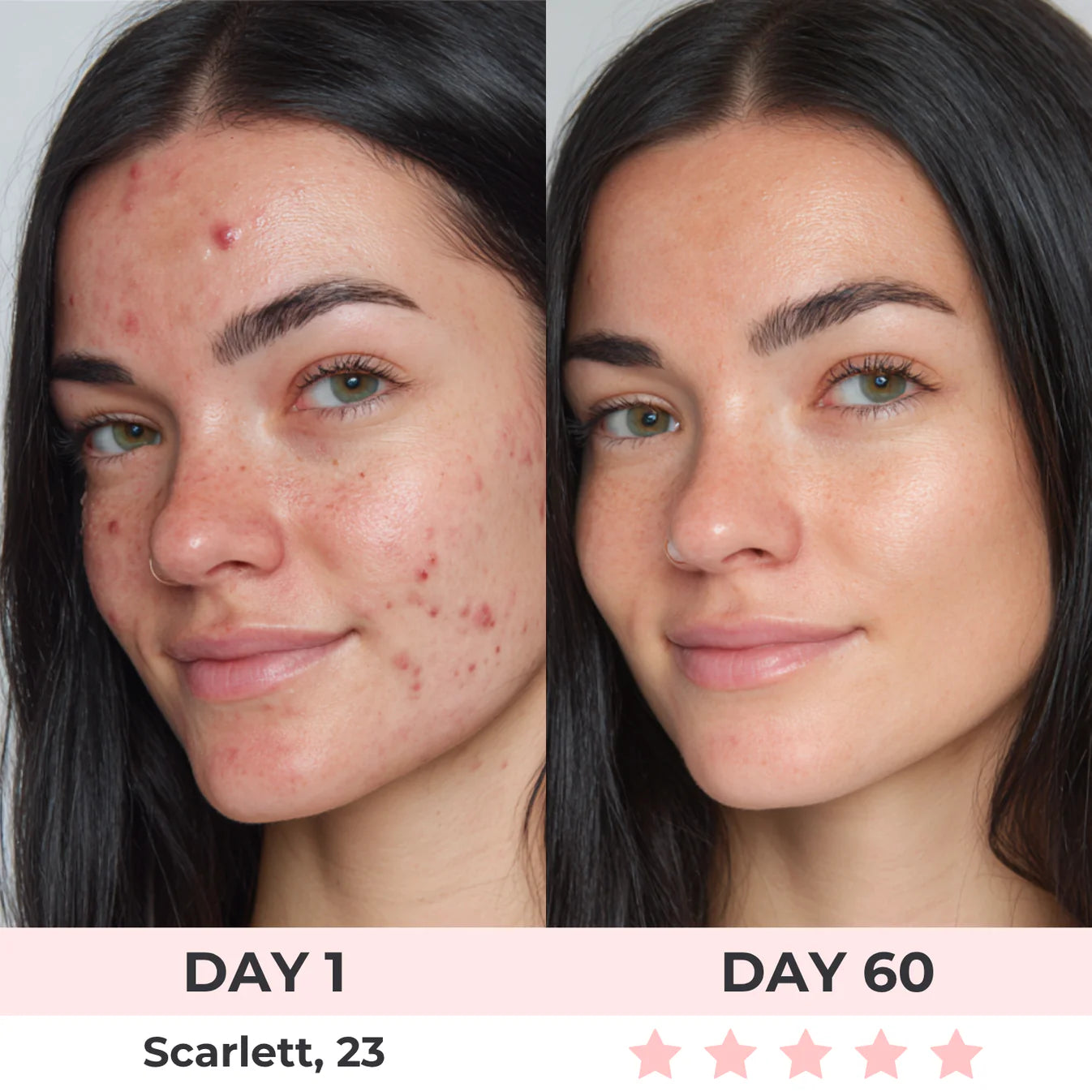 ContourGlow Facial Cupping & Sculpting System