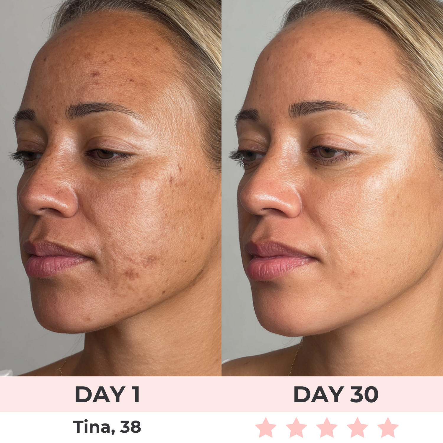 7-in-1 LED Facial Sculptor