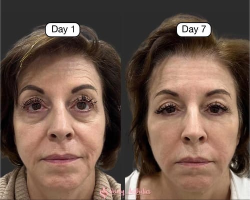 Lift & Glow Lymphatic Brush