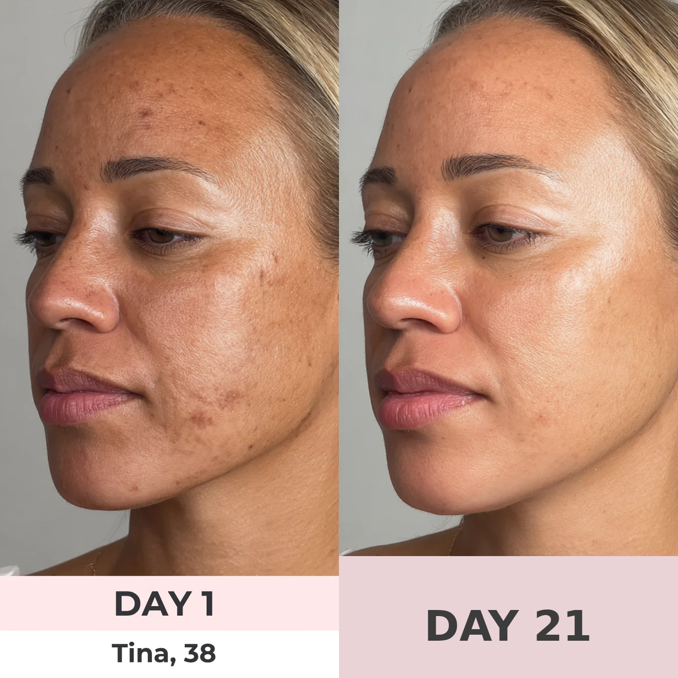 ContourGlow Facial Cupping & Sculpting System