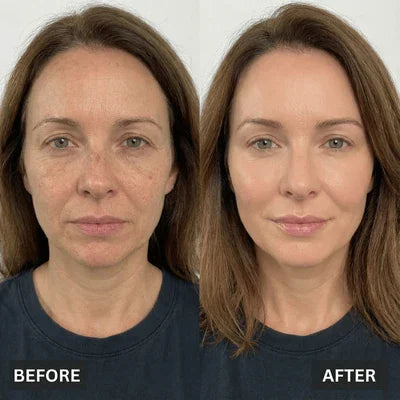 Before and After
