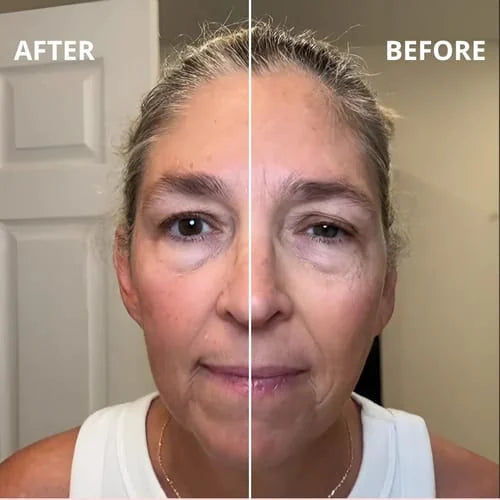 Before and after — full face